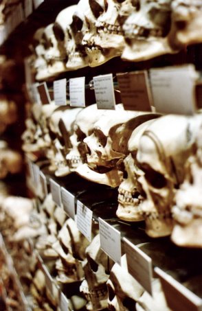 hyrtl skull collection